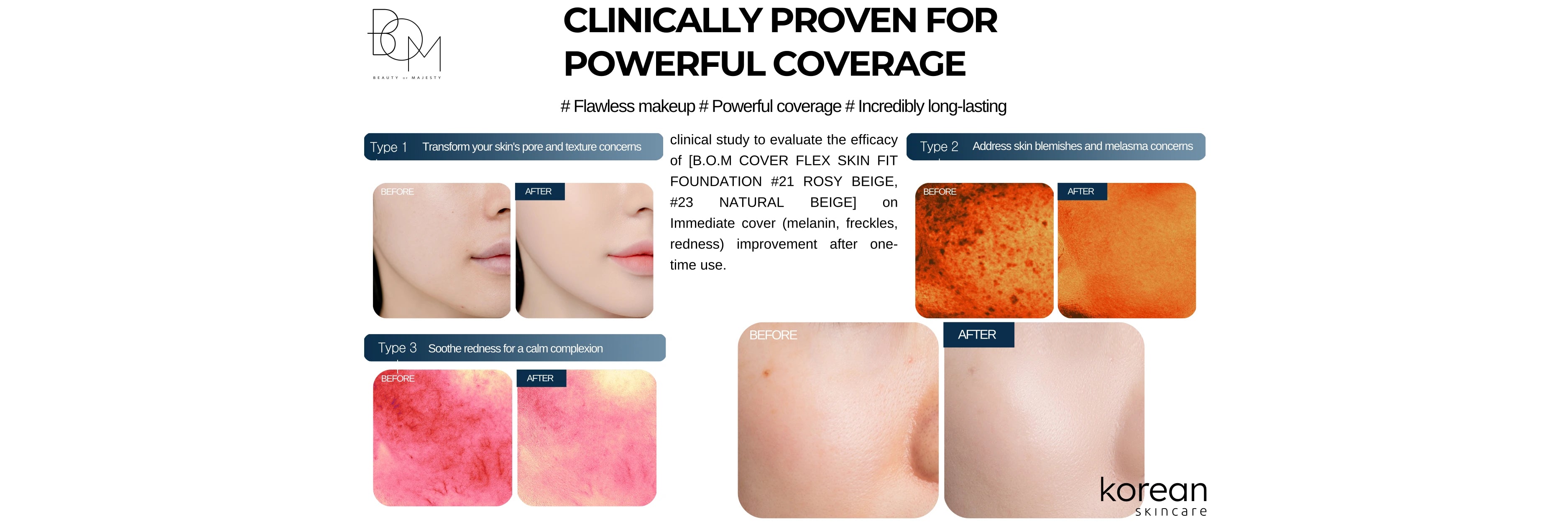 Foundation for all Skin Types
